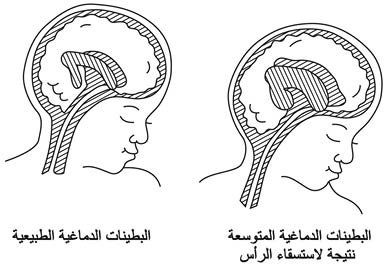 الوصف: 17-2.psd