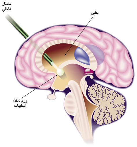 الوصف: 17-8.psd